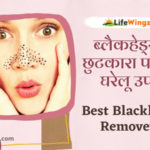 8 best home remedies for blackheads removal