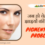 Best 7 Home remedies for Pigmentation.