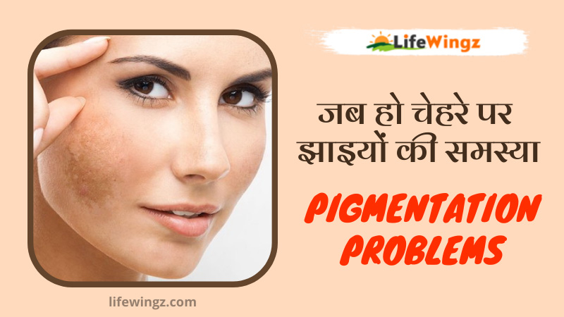 Best 7 Home remedies for Pigmentation.