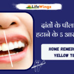 Teeth Whitening at Home