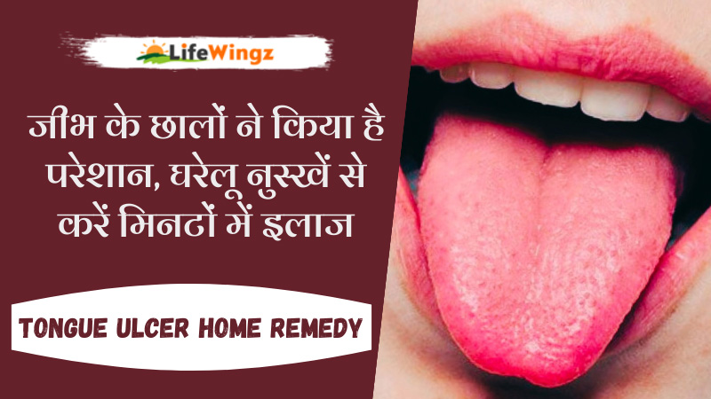 Home remedies for Tongue Ulcer